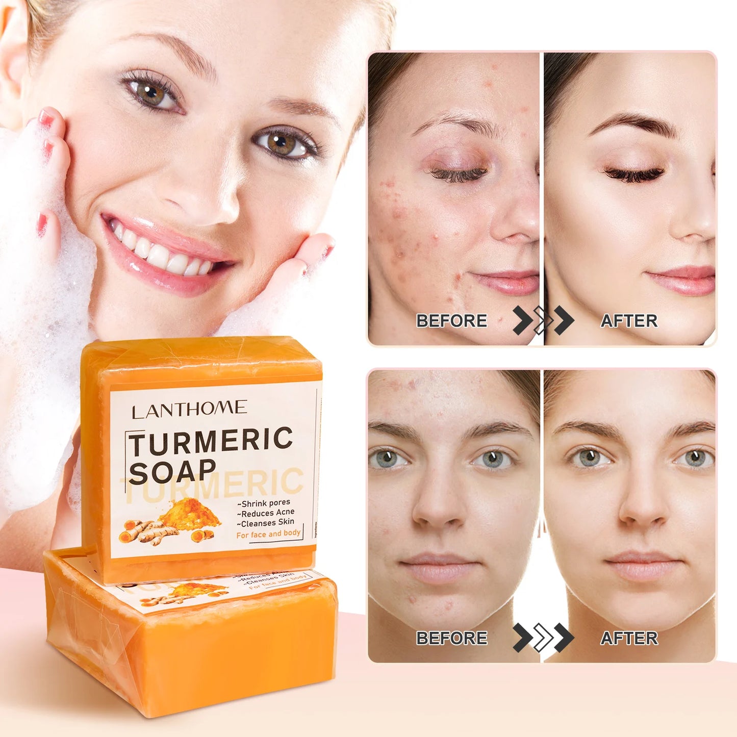 3PCS Turmeric Skincare Set – Brightening Face Soap, Essential Oil & Whitening Cream
